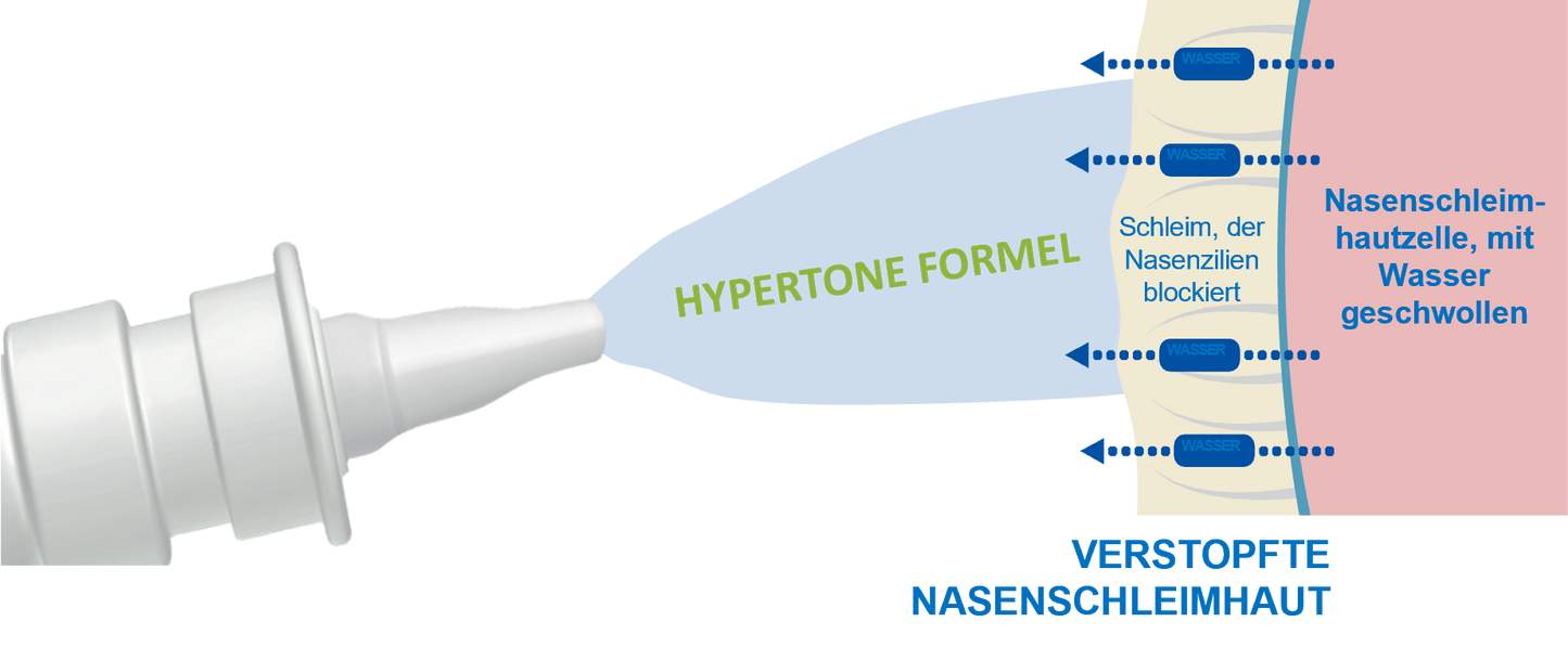 Sterimar Nasenspray verstopfte Nase Baby