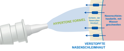 Sterimar Nasenspray verstopfte Nase Baby